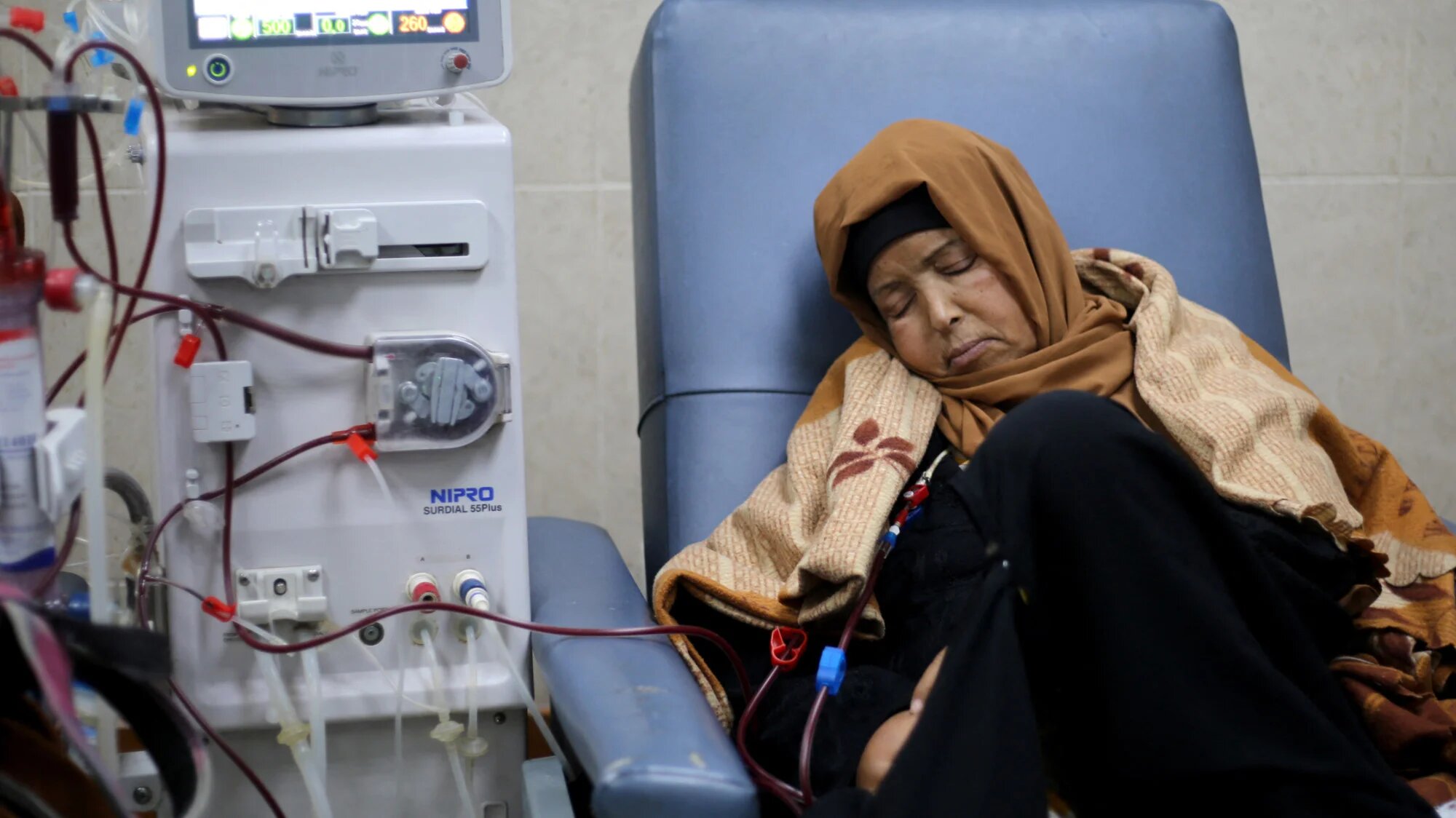 A Palestinian patient with kidney failure undergoes dialysis treatment at Al-Aqsa Martyrs Hospital, in Deir al-Balah in central Gaza, on 1 February 2026 (Eyad Baba/AFP)